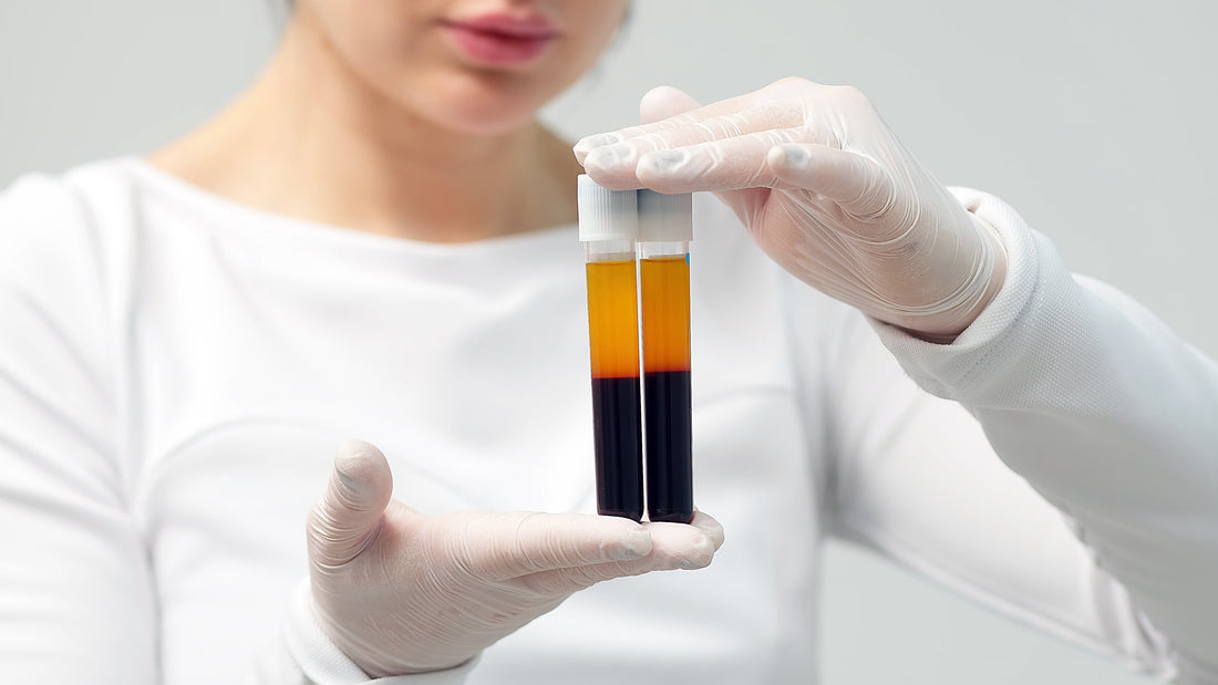 Is Platelet-Rich Plasma the Secret to Younger-Looking Skin?